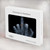 W1143 X-ray Hand Middle Finger Hülle Schutzhülle Taschen für MacBook Air 13″ (2022,2024) - A2681, A3113