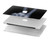 W3101 X-ray Peace Sign Fingers Hülle Schutzhülle Taschen für MacBook Air 15″ (2023,2024) - A2941, A3114