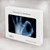 W3239 X-Ray Hand Sign OK Hülle Schutzhülle Taschen für MacBook Air 15″ (2023,2024) - A2941, A3114