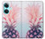 W3711 Pink Pineapple Hülle Schutzhülle Taschen und Leder Flip für OnePlus Nord CE3