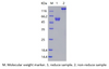 Recombinant Human LAIR1 (C-mFc)