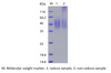 Recombinant Human CD200R1(C-His)