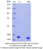 Recombinant Human CST3(Mammalian, C-His)