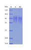 Recombinant Mouse B7-1/CD80 (C-His)