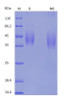 Recombinant Human B7-1/CD80 (C-His)