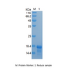 Recombinant Human Zinc finger protein 75A/ZNF75A (N-His)