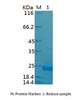 Recombinant Human Heat Shock Protein β-2/HSPB2/MKBP (C-6His)