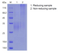 Recombinant Human NKG2-A/NKG2-B Type II Integral Membrane Protein(N-His)