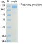 Recombinant Human ACE2 Protein (C-His)