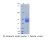 recombinant Human Mesothelin/MSLN (C-His)