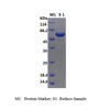 Recombinant E.coli 6-Phospho-Beta-Glucosidase/BGLA (N-His)