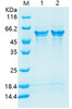 Recombinant Human Cellular Tumor Antigen p53 (N-His)