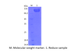 Recombinant Human ErbB2/Her2(C-His)