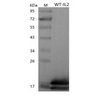 Recombinant Human Interleukin-2/IL2 (C-His)