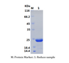 Recombinant Pig Interleukin-11/IL-11 (N-His)