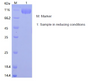 Recombinant Human Siglec-2/CD22 (C-His)