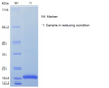 Recombinant Human Anterior gradient protein 2 homolog/AGR2(C-His)