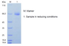 Recombinant Human Insulin-like Growth Factor Binding Protein 3/IGFBP3 (C-hFc)