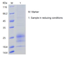 Recombinant Human Interferon gamma/IFN-gamma (C-His)
