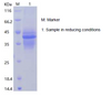 Recombinant Human Interleukin-12/IL-12 (C-His)