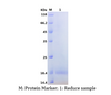 Recombinant Human Interleukin-18/IL-18