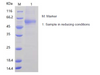 Recombinant Human Osteoprotegerin/OPG/TNFRSF11B (C-His)
