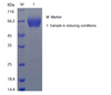 Recombinant Human Tyrosine-protein Kinase Receptor UFO/AXL (C-His)