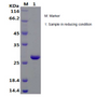 Recombinant C. jejuni Cytolethal Distending Toxin B/CdtB (N-His)
