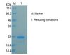 Recombinant Human Ciliary Neurotrophic Factor/CNTF