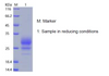 Recombinant Human Interleukin-7/IL-7 (C-His)