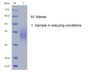 Recombinant Human Interleukin-22/IL-22 (C-His)
