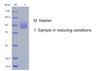 Recombinant Human Interleukin-12 Subunit Beta/IL-12B (C-His)