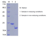 Recombinant Human Retinol-Binding Protein 4/RBP4 (C-His)