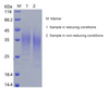 Recombinant Human Alpha-1-Acid Glycoprotein 1/AGP1 (C-His)
