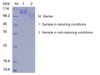 Recombinant Human E-selectin/ELAM1/CD62E (C-His)