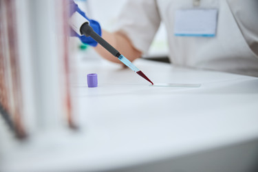 cDNA Products cDNA Products