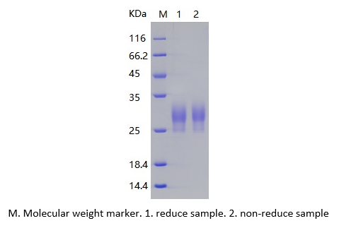 Recombinant Human LAIR1 (C-His)
