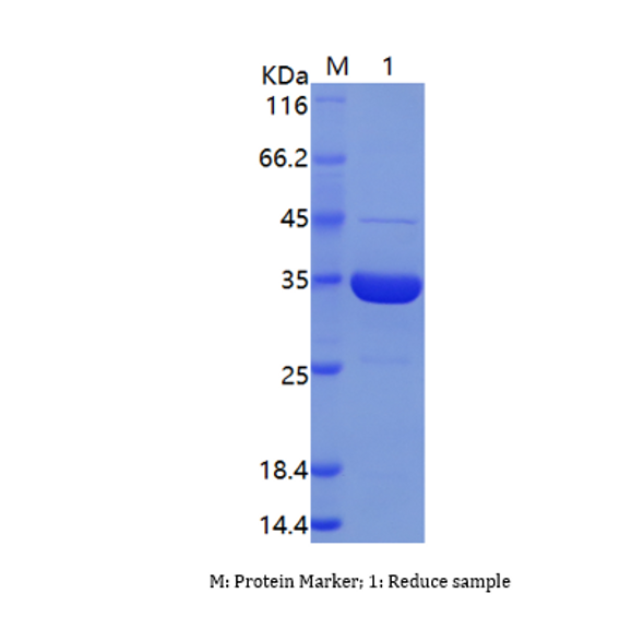 Recombinant Human Ribose-Phosphate Pyrophosphokinase 2/PRPS2 (C-His)