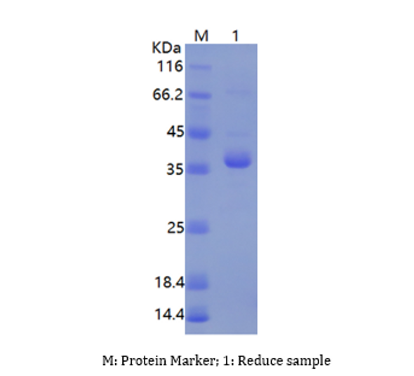 Recombinant Human ZW10 Interactor/ZWINT (N-His)
