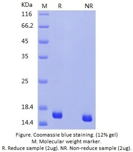 Recombinant Human CST3(Mammalian, C-His)