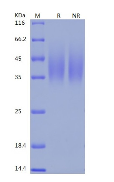 Recombinant Mouse B7-2/CD86 (C-His)