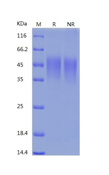 Recombinant Mouse B7-1/CD80 (C-His)