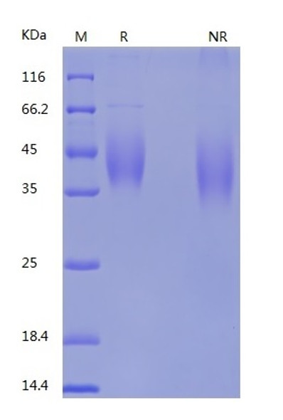 Recombinant Human B7-1/CD80 (C-His)