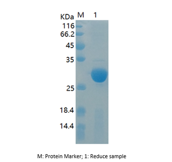 Recombinant Human Thymidylate Kinase/DTYMK (N-His)