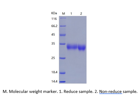 Recombinant Mouse VSIG4 (C-His)