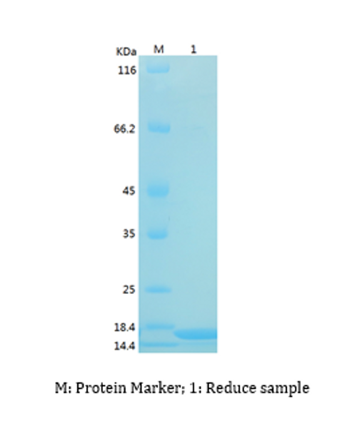 Recombinant Human UBE2B/HR6B