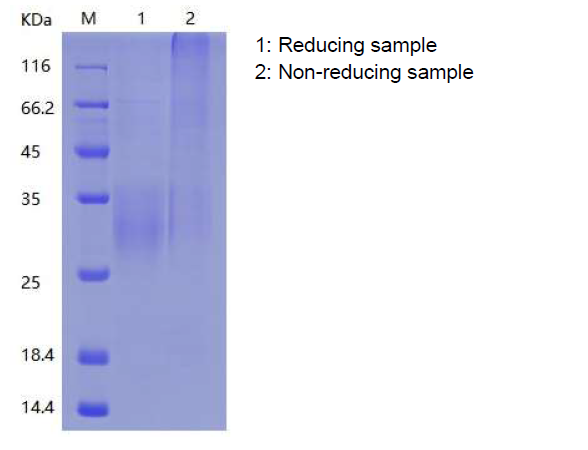 Recombinant Human NKG2-A/NKG2-B Type II Integral Membrane Protein(N-His)