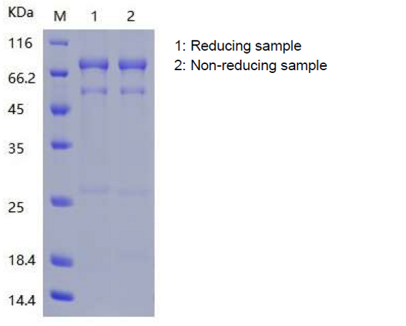 Recombinant Human Collagen a-1(VIII) Chain/COL8A1 (C-6His)