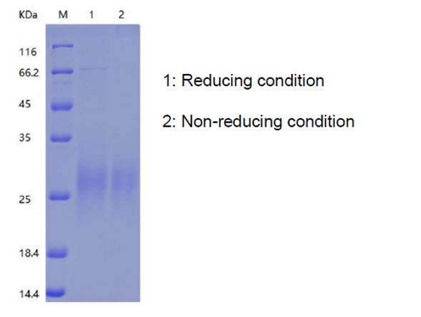Recombinant Human Uroplakin-2/UPK2 (C-His)