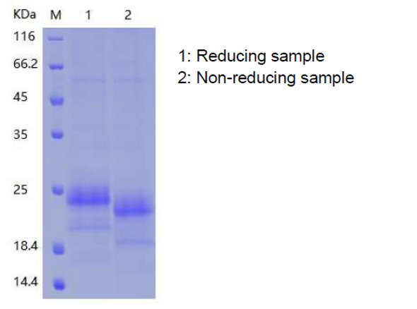 Recombinant Human COQ7 (C-6His)